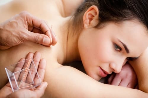 Acupuncture Clinic Business Plan [Updated for 2023- Free Template in PDF]